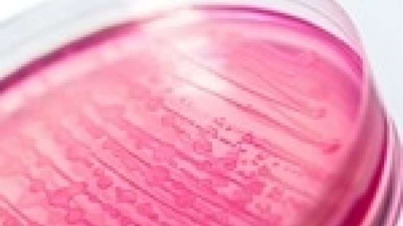 Opioid-Free Anesthesia Decreases Adverse Events During Cardiac Surgery
