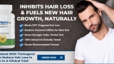 Reviews of Profollica: Fake Results ? Or Legit Hair Recovery System For Men